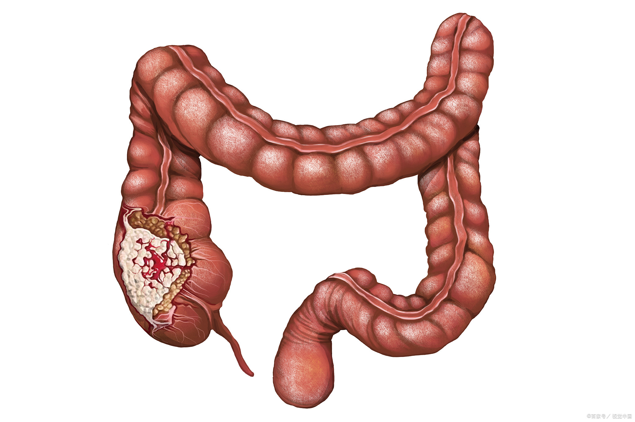 Ge Jie intestines (commonly used quantity for gecko)